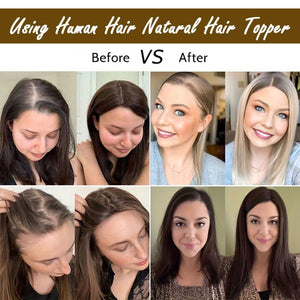 Hair Toppers 9.8” 100% Real Hair Piece Dark Brown Wig - Wigtrends
