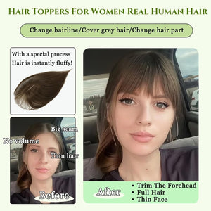 Hair Toppers for Women Real Human Hair 360°3D Bangs Hair Clip with Thinning Hair Realistic Scalp Line Hair Topper - Wigtrends