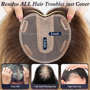 Real Hair Toppers for Women with Thinning Hair - Wigtrends