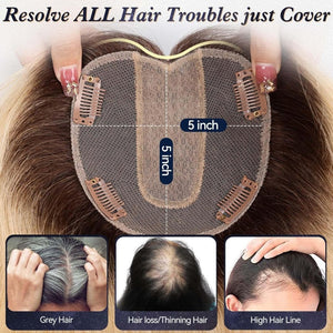 Real Hair Toppers for Women with Thinning Hair - Wigtrends